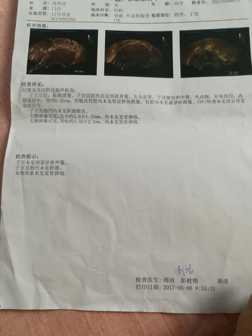 残留物排出来是什么样的图片