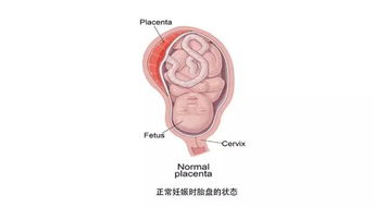 帆状胎盘几周开始危险宝宝知道