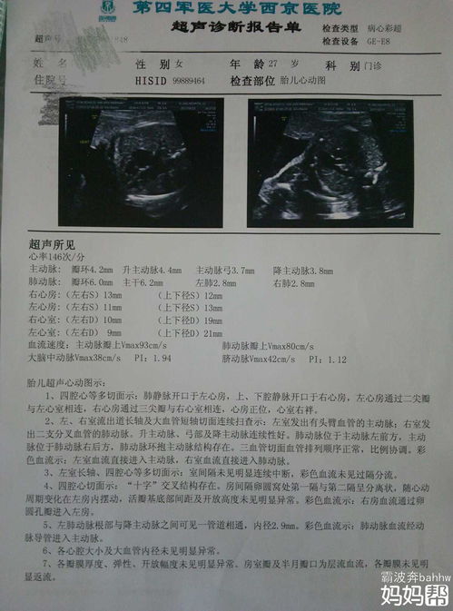 胎儿心脏彩超能检查出什么毛病