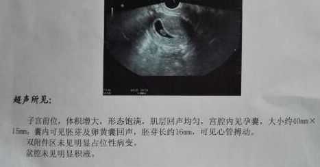 怀孕8周出血了怎么办呀