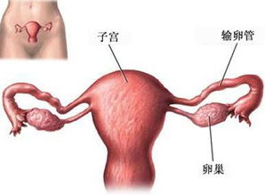 怀孕了发现卵巢囊肿怎么办