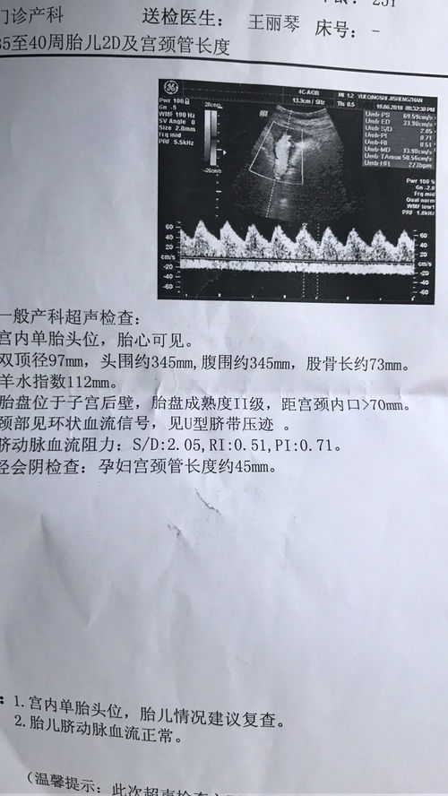 孕38周胎儿双顶径标准是多少