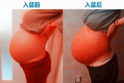 怀孕33周零4天胎儿胎动很厉害怎么办