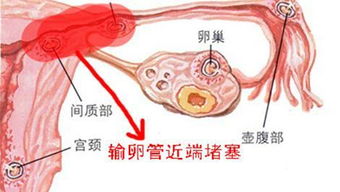 输卵管造影有什么危害么