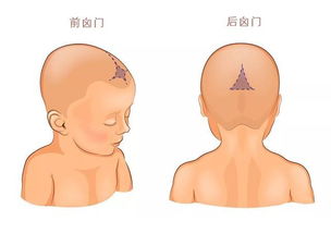 新出生的婴儿脑门要弄棉花保护到吗？