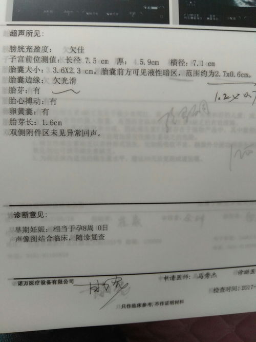 B超示孕囊下有液暗区能诊断为先兆流产吗?请教教？