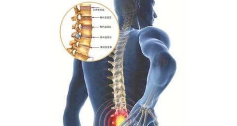 腰椎管狭窄吃什么药比较好啊