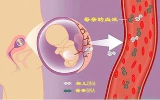 孕期唐氏筛查过了没做无创可以吗