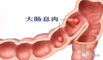 叶酸吃多了会不会有副作用