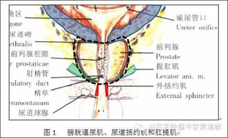 尿失禁应该如何治疗？