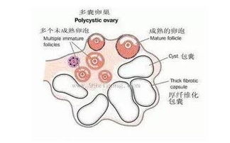 卵泡萎缩打破卵针可以排出吗