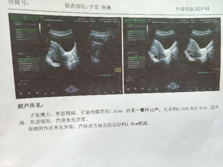 怀孕40天能否做B超？能看见孕囊吗？