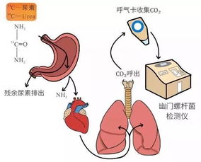 幽门螺杆菌检测多久后可以备孕