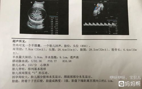 孕29周股骨长多少正常范围