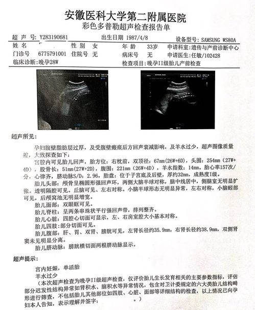 胎儿脑积水诊断标准最新