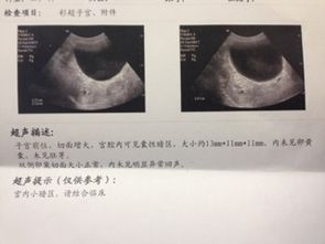 怀孕六个月 胎心