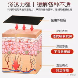 治疗颈椎病的膏药有哪些