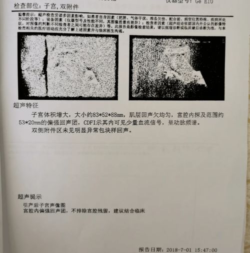 黄体功能不足但怀孕了