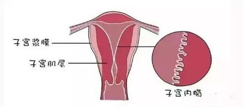 宫腔粘连怀孕了还能要吗