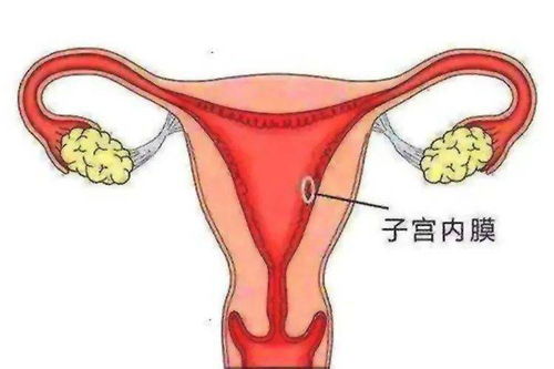 女性内膜薄怎么治疗食补