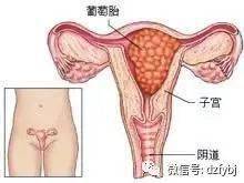 清宫手术前能喝水吗女性