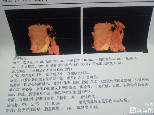 胎儿双肾分离1.0mm问题大吗？？