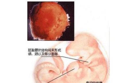 29周胎儿后颅窝池9.5mm正常吗？要注意哪些情况