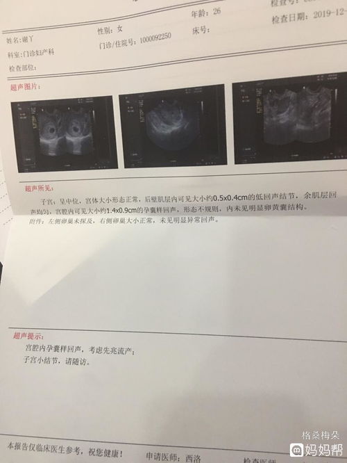 怀孕B超检查45天，只有卵黄囊和孕囊，是不是空孕囊