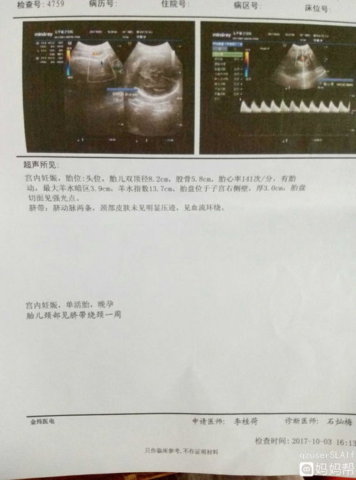 刚怀孕身体有什么变化呢?