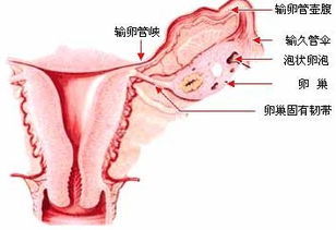 多囊卵巢综合症怎么治