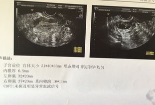 卵泡什么时间能排