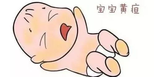 母乳性黄疸一定要停母乳才能退吗？