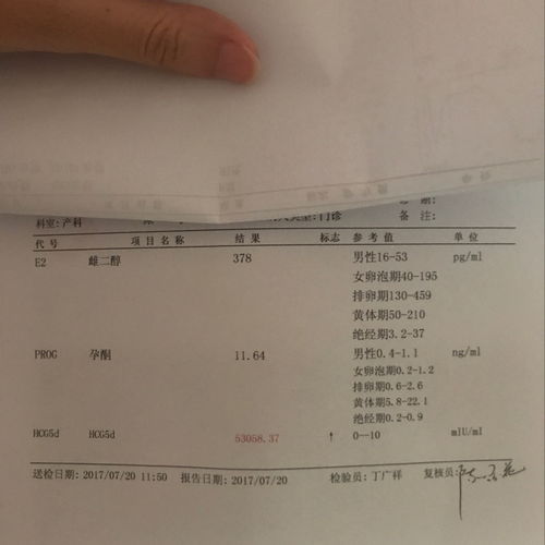 怀孕多久能看到孕囊