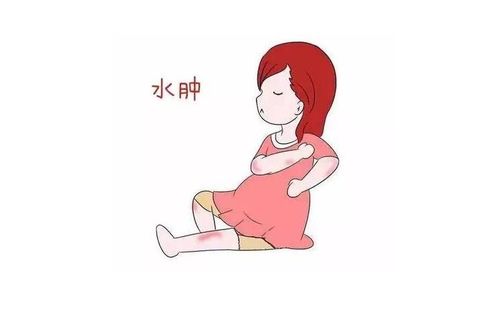 孕妇为什么会水肿怎么办