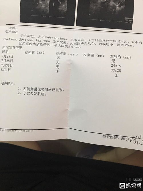 卵泡长到多大会排出来