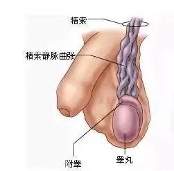 精索静脉曲张的症状怎么引起的