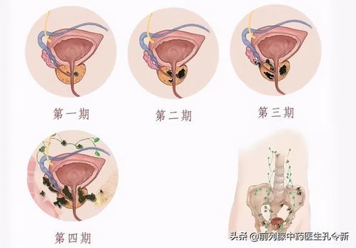 男性乳腺增生要紧吗18岁