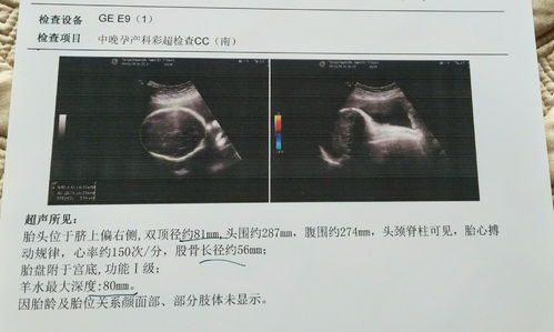 40多天卵黄囊多大正常