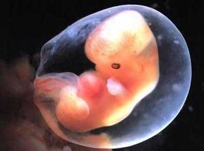 卵黄囊8mm未见胎芽胎心还有希望吗