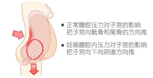 第一胎做试管生的，第二胎还必须做试管吗