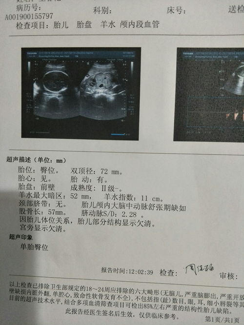 产检医生会告诉你胎儿性别吗