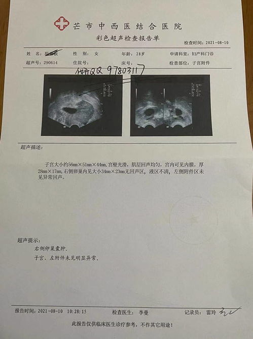 怎么看四维彩超结果单