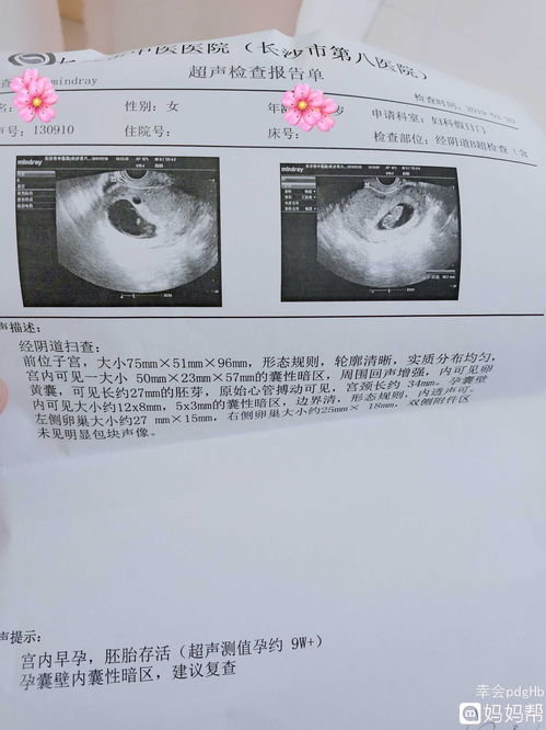 于孕囊周边可探及范围约2.4x1.2不规则液性暗区是什么意思？