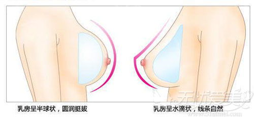 乳腺增生是什么样的症状？应该怎么样治疗？