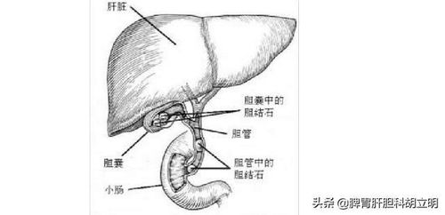 妊娠胆囊炎怎么引起的呢