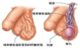 男人经常阴囊潮湿是怎么回事