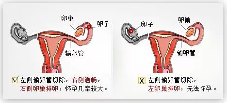 女生第一次怀孕的几率大吗？