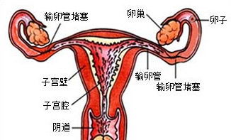 女性输卵管不通是什么症状