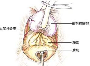 前列腺炎引起腰痛如何治疗