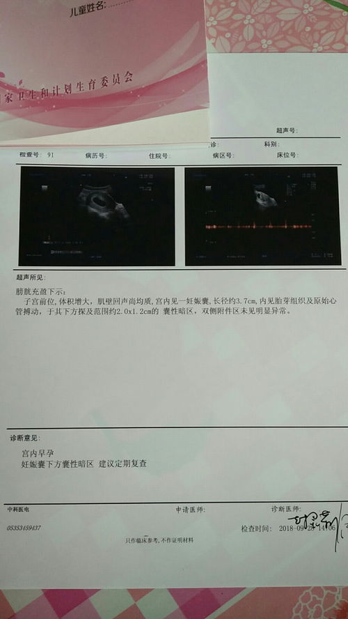 孕囊的大小10*8mm,已经怀孕58天，请问这正常吗